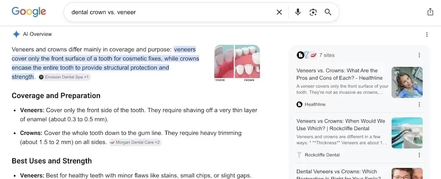 ai overview result for crown vs. veneer
