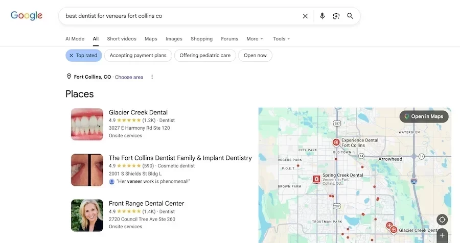 best dentist for veneers fort collins google search results
